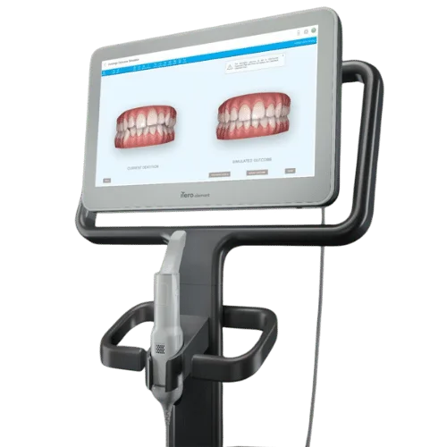 iTero equipamento odontologia digital